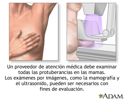 De pecho implanty son mejor el coste